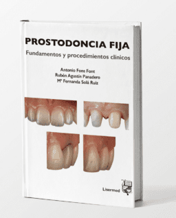 PROSTODONCIA FIJA. Fundamentos y procedimientos clínicos