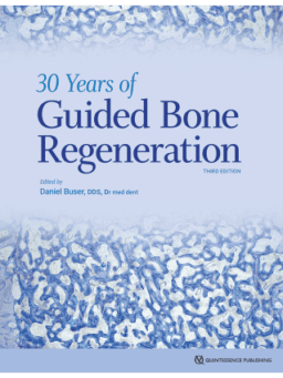 THE 30 YEARS OF GUIDED BONE REGENERATION