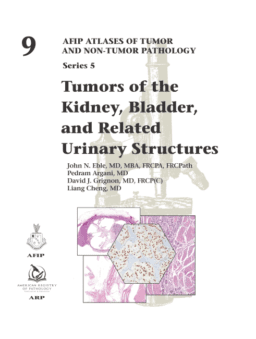 Tumors of the Kidney, Bladder, and Related Urinary Structures (AFIP Atlases of Tumor and Non-Tumor Pathology, Series 5, Vol. 9)