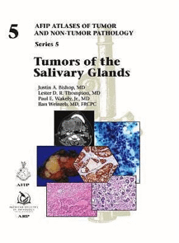 Tumors of the Salivary Glands (AFIP Atlases of Tumor and Non-tumor Pathology, Series 5, Vol. 5)
