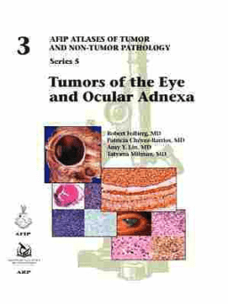 Tumors of the Eye and Ocular Adnexa (AFIP Atlases of Tumor and Non-tumor Pathology, Series 5, Vol. 3)