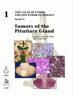 Tumors of the Pituitary Gland (AFIP Atlas of Tumor and Non-Tumor Pathology Series 5, Vol. 1)