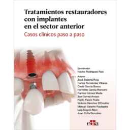 TRATAMIENTOS RESTAURADORES CON IMPLANTES EN EL SECTOR ANTERIOR. CASOS CLÍNICOS PASO A PASO