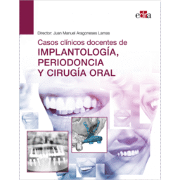 CASOS CLÍNICOS DOCENTES DE IMPLANTOLOGÍA, PERIODONCIA Y CIRUGÍA ORAL