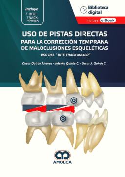Uso de Pistas Directas para la Corrección Temprana de Maloclusiones Esqueléticas. Uso del Bite Track Maker""