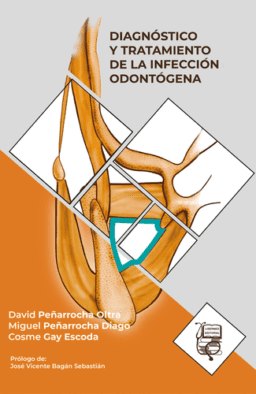 DIAGNÓSTICO Y TRATAMIENTO DE LA INFECCIÓN ODONTÓGENA