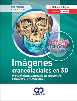 Imágenes Craneofaciales en 3D. Procedimientos Actuales en Ortodoncia, Cirugía Oral y Maxilofacial