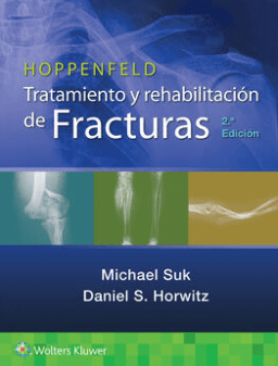 HOPPENFELD Tratamiento y Rehabilitación de Fracturas