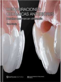 RESTAURACIONES CERÁMICAS ANTERIORES – DETALLES QUE MARCAN DIFERENCIA
