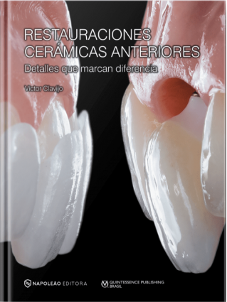 RESTAURACIONES CERÁMICAS ANTERIORES – DETALLES QUE MARCAN DIFERENCIA
