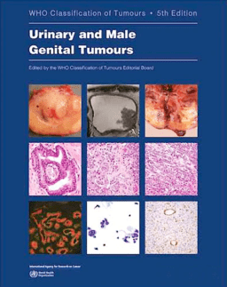 WHO Classification of Tumours: Urinary and Male Genital Tumours (WHO Classification of Tumours, Vol. 7)