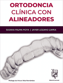 Ortodoncia Clínica con Alineadores