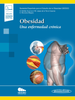 Obesidad. Una enfermedad crónica.
