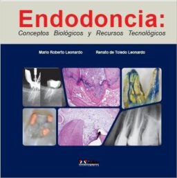 Endodoncia. Conceptos Biológicos y Recursos Tecnológicos