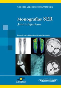 Monografías SER. Artritis Infecciosas