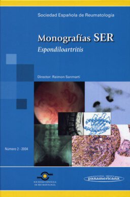 Monografías SER. Espondiloartritis