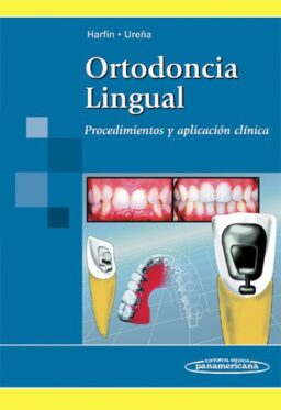 Ortodoncia Lingual. Procedimientos y aplicación clínica