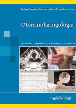 Otorrinolaringología. Manual clínico