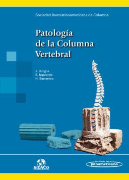 Patología de la Columna Vertebral