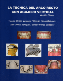 LA TÉCNICA DEL ARCO RECTO CON AGUJERO VERTICAL