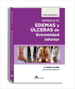Guía de Bolsillo Abordaje de Edemas y Úlceras de Extremidad Inferior