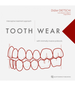 TOOTH WEAR INTERCEPTIVE TREATMENT APPROACH WITH MINIMALLY INVASIVE PROTOCOLS