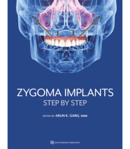 ZYGOMA IMPLANTS STEP BY STEP