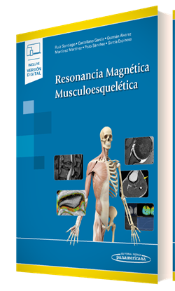 Resonancia Magnética Musculoesquelética