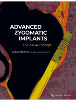 ADVANCED ZYGOMATIC IMPLANTS THE ZAGA CONCEPT