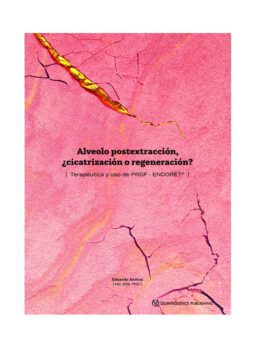 ALVEOLO POSTEXTRACCIÓN CICATRIZACIÓN O REGENERACIÓN