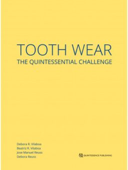 tooth wear