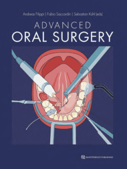 advanced oral surgery