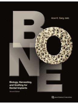 bone-biology-harvesting-and-grafting-for-dental-implants