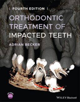 ORTHODONTIC IMPACTED TEETH