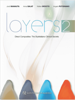 layers direct composites