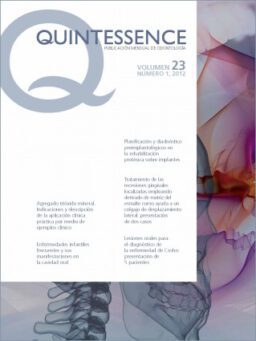 QUINTESSENCE INTERNACIONAL