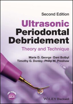 ultrasonic-periodontal-debridement