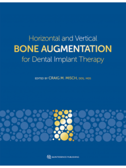 HORIZONTAL AND VERTICAL BONE AUGMENTATION FOR DENTAL IMPLANT THERAPY