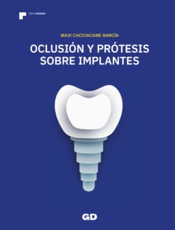 protésis sobre implantes
