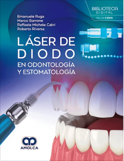 laser diodo
