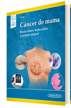 cancer de mama