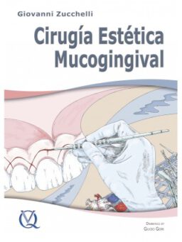 cirugía estética mucogingival