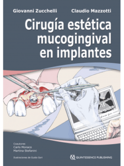 CIRUGÍA ESTÉTICA MUCOGINGIVAL