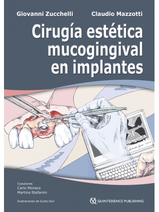 CIRUGÍA ESTÉTICA MUCOGINGIVAL