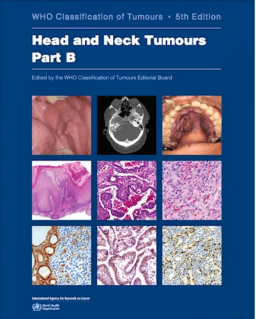 TUMOURS HEAD AND NECK
