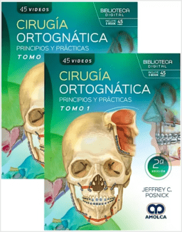 cirugía ortognática