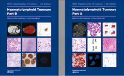 haematolymphoid tumours