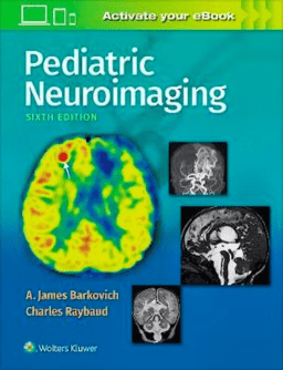 Pediatric Neuroimaging