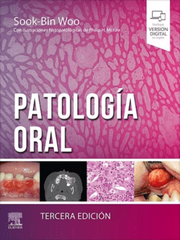 patología oral