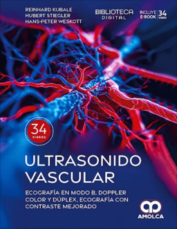 ultrasonido vascular